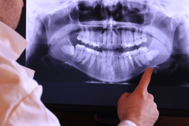 Best Emergency Treatment for Toothache in Newell, WV